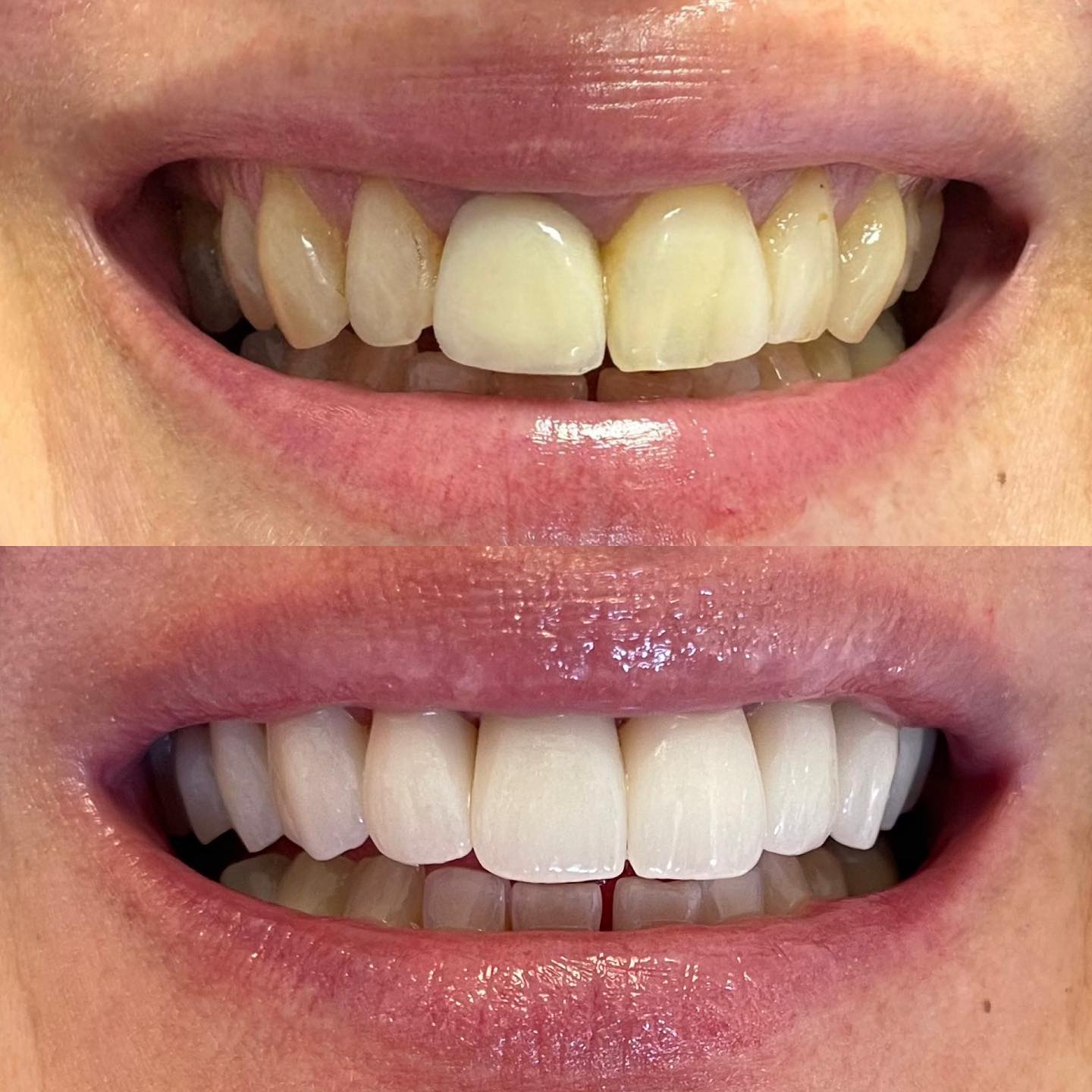 518981677_18516816661050464_8571845216544848093_n